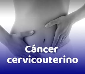 Cáncer cervico uterino (CACU)